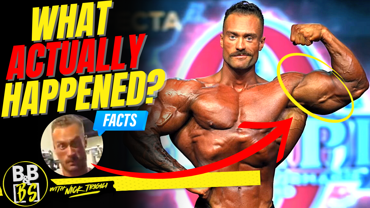 Chris Bumstead Deformed Bicep at The Mr.Olympia Finally Explained