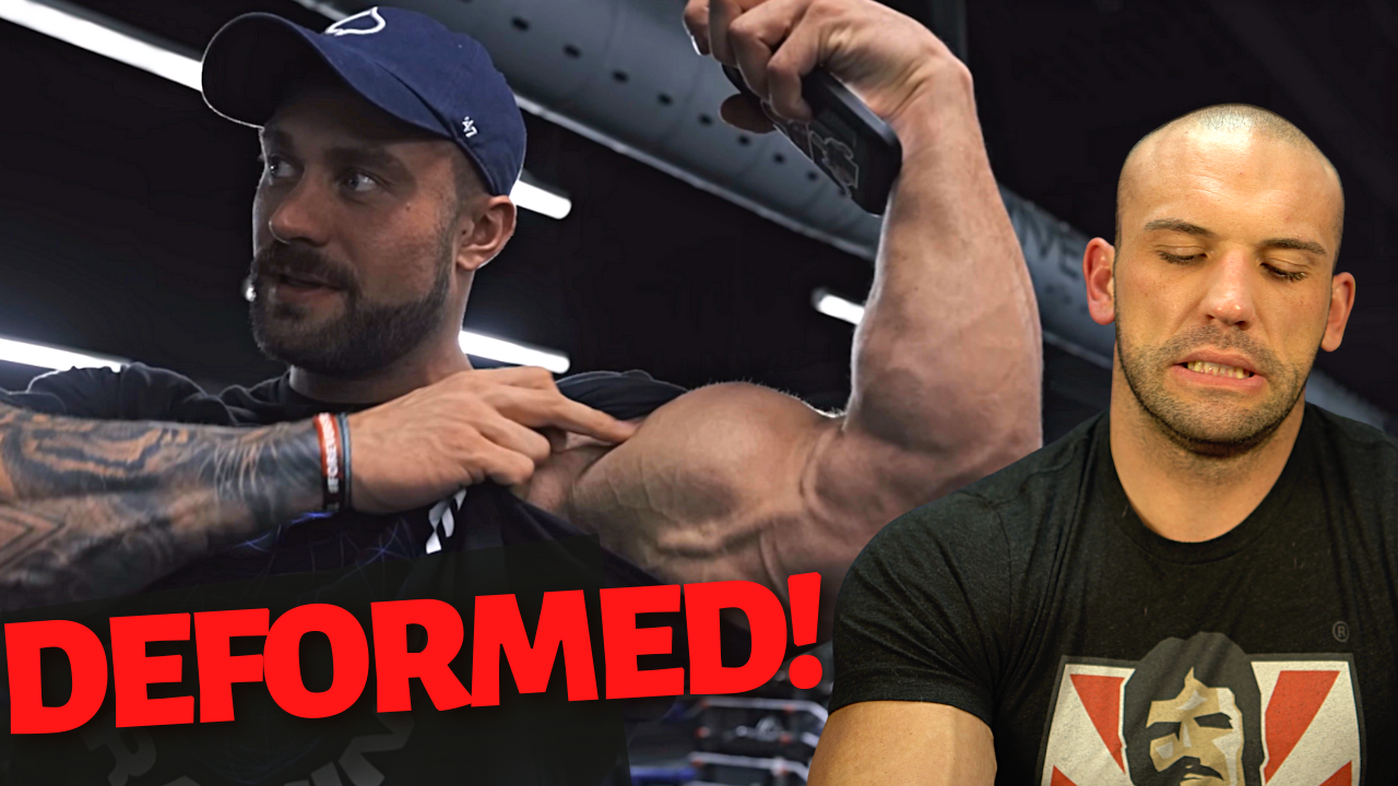Chris Bumstead Gives Update on Torn Bicep, Can He Win a 5th Olympia?