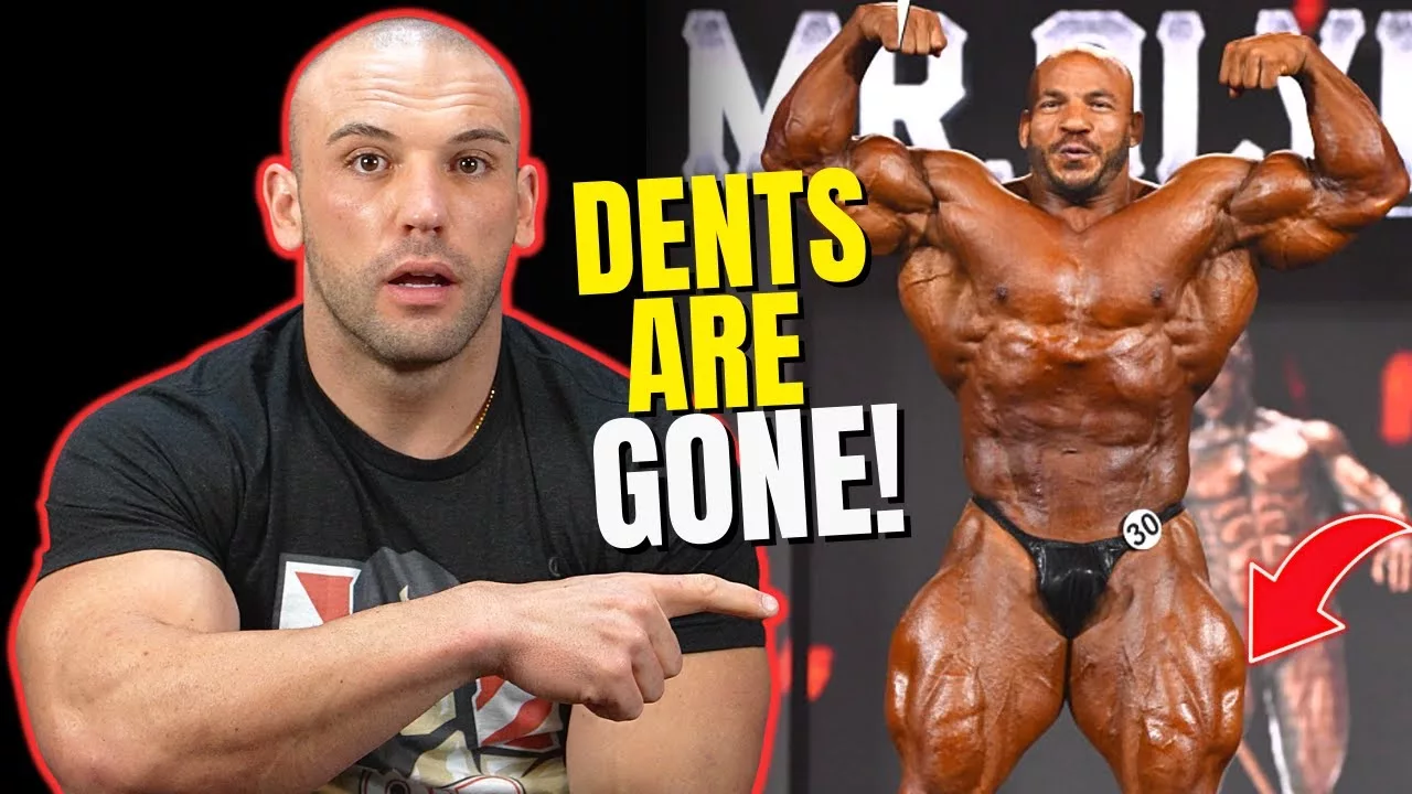 Big Ramy’s Quads Are FIXED!